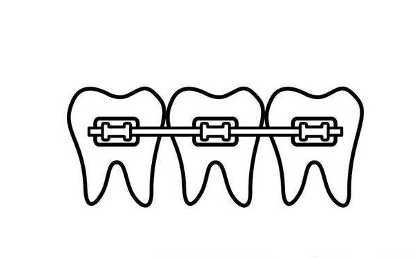 南京医科大学第四附属医院口腔科牙齿矫正怎么收费？医院正不正规