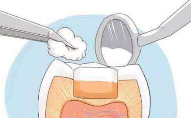 14岁牙齿矫正多少钱