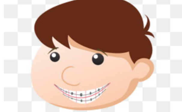 温州医科大学附属口腔医院口腔科龅牙矫正技术怎么样?180天矫正案例点评