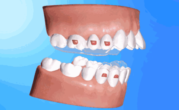 拔一颗智齿大约多少钱