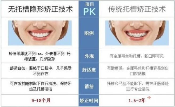 上海九院矫正牙齿大概多少钱&正畸医生实力/挂号全攻略